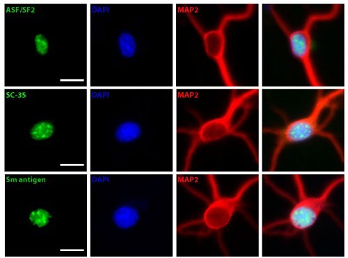 ASF/SF2 : facteurs d'épissage SC35 : protéine marqueur des speckles Sm Ag : marqueur des snRNP (épissage) MAP2 : type de fibrille dans les cellules dendritique